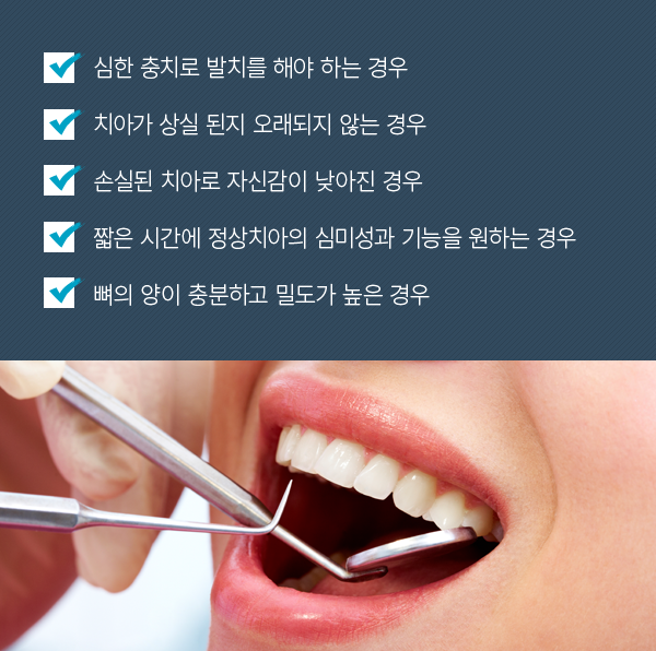 ��ġ��� ���ö�Ʈ ���