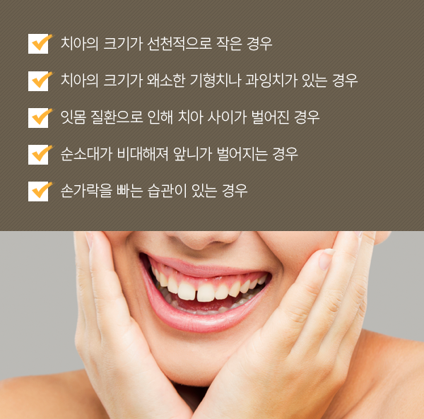 ġ�ư� �������� ����