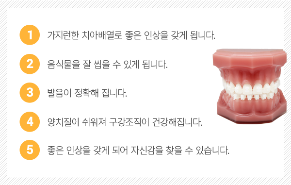 S-line���� ����