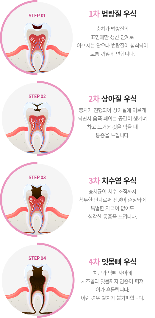 ��ġ�� ����ܰ�