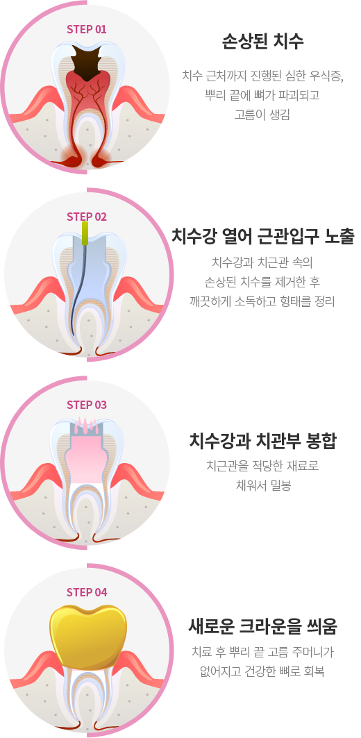 �Ű�ġ�� ����