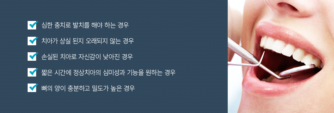 ��ġ��� ���ö�Ʈ ���