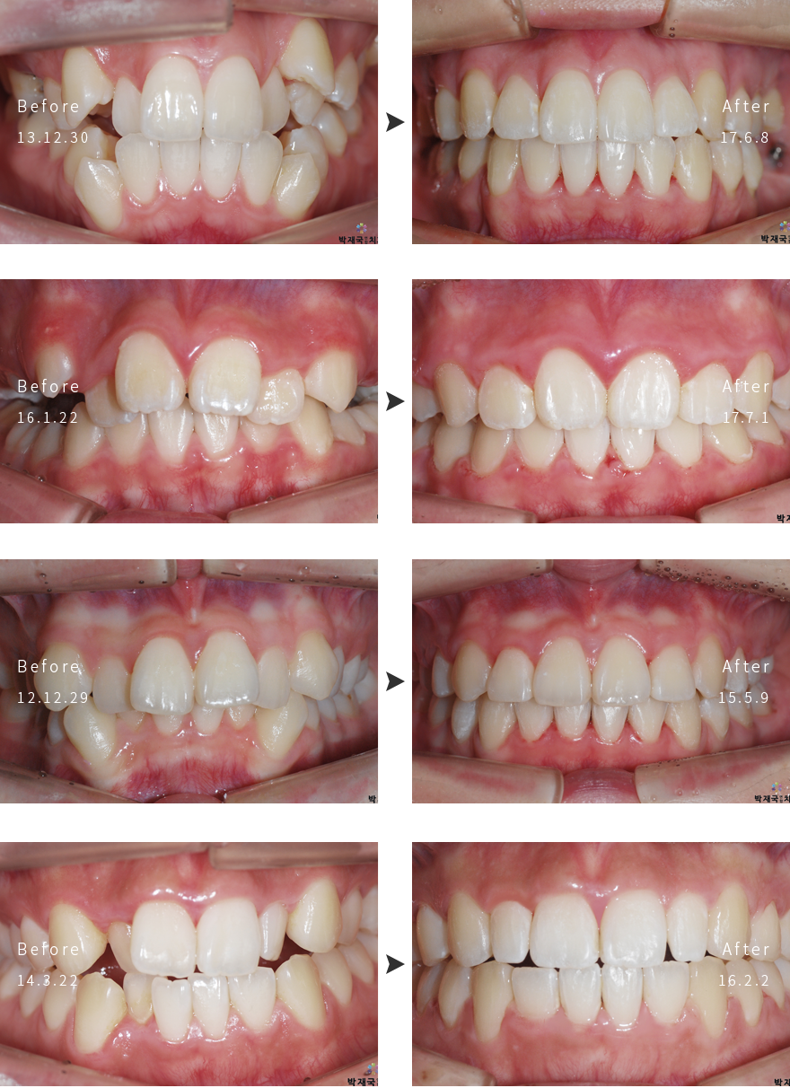 ���ϱ��� ���