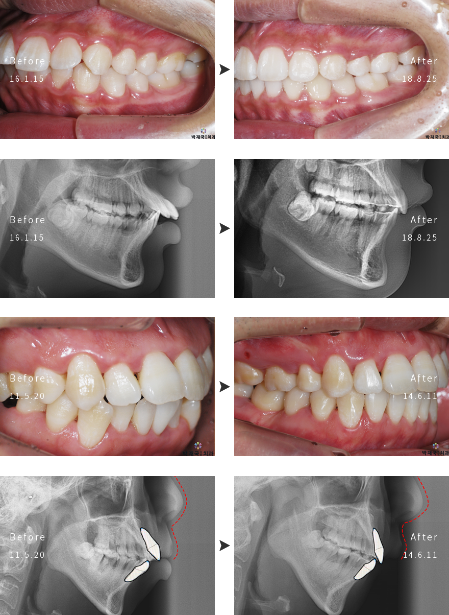 �����Ա��� ���