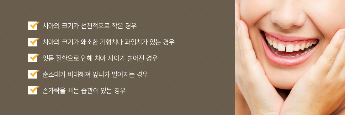 ġ�ư� �������� ����