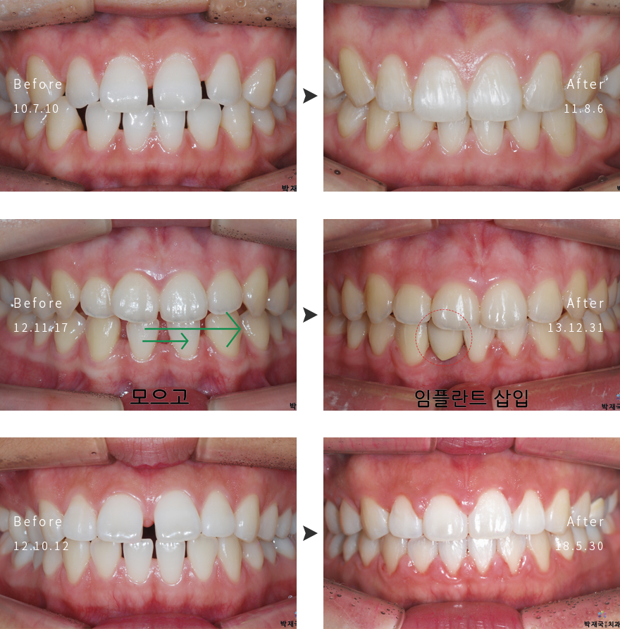 ������ �� ���� ���