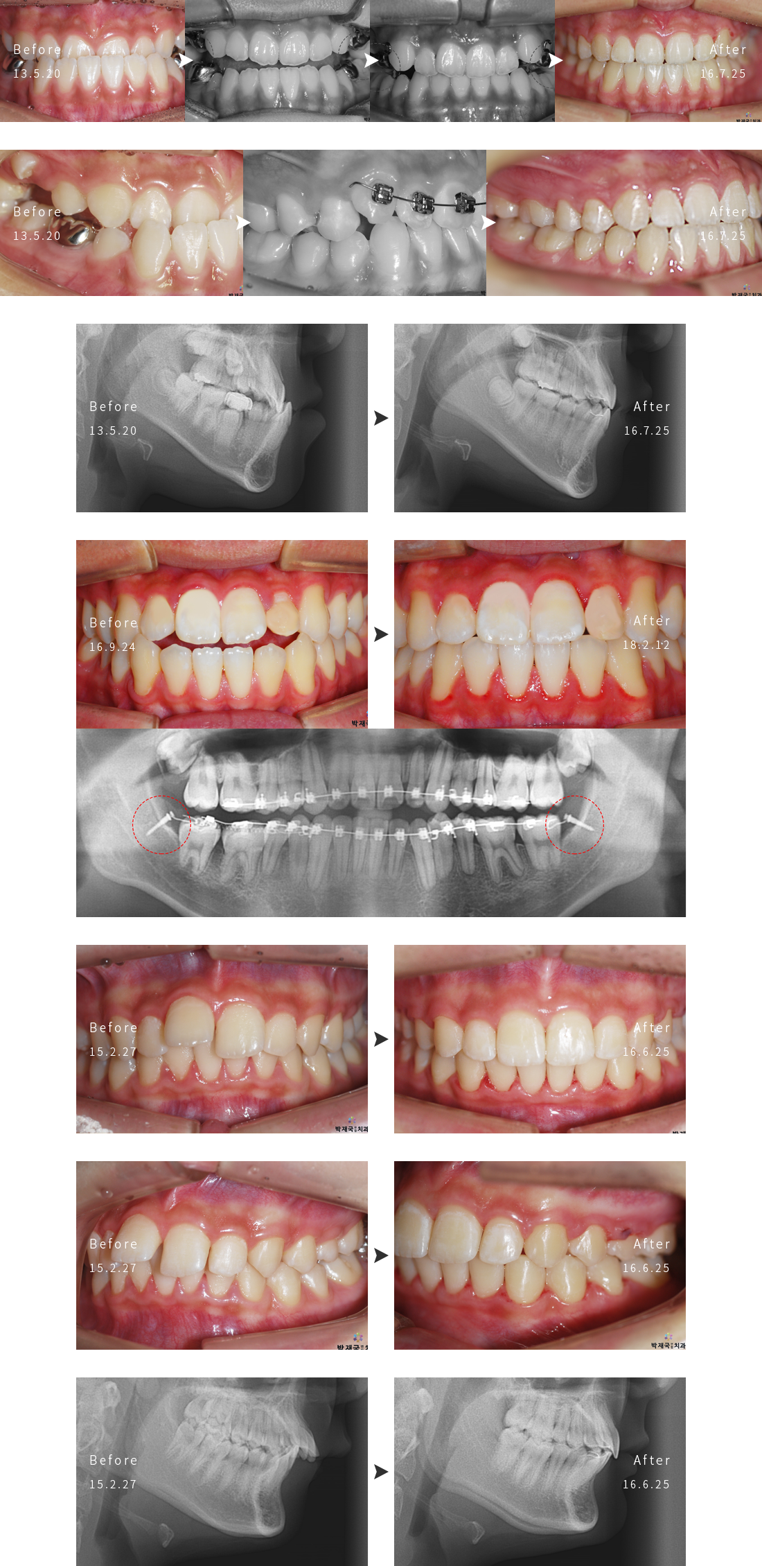 �ְ��α��� ���