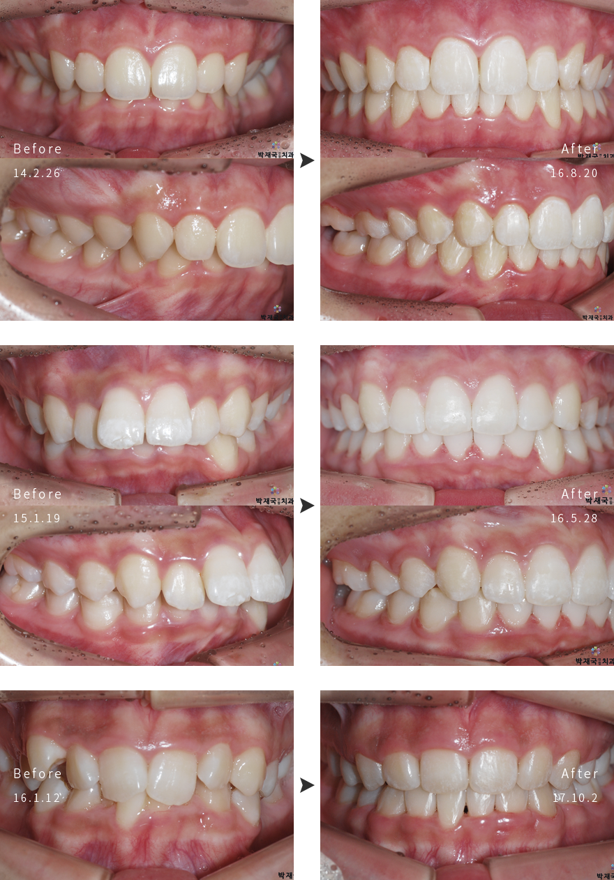 �������ձ��� ���