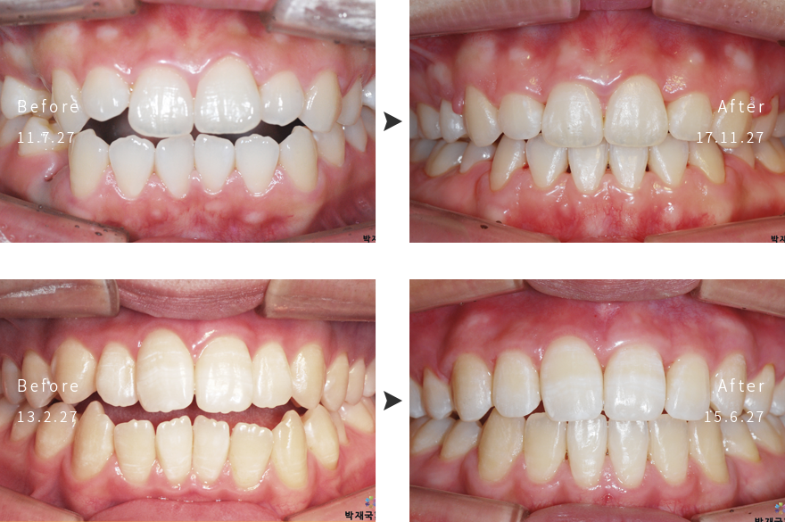 ���汳�ձ��� ���