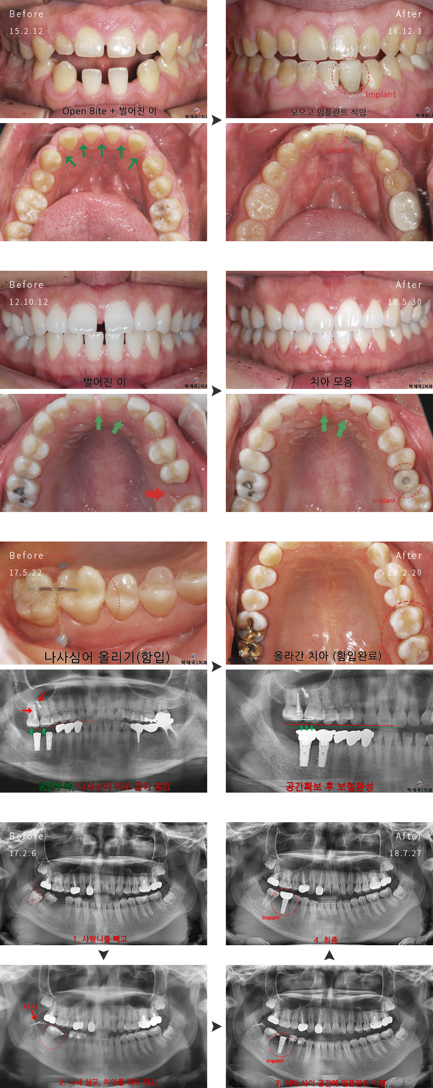 ���α��� ���