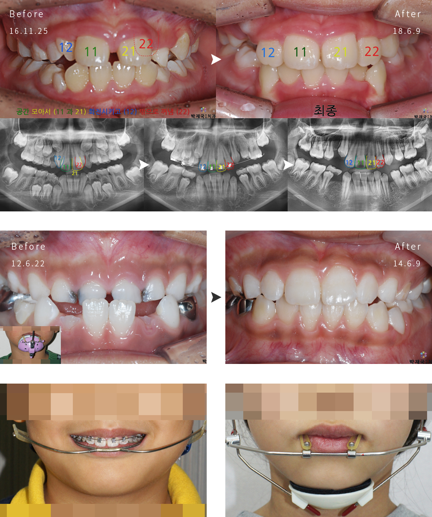 ��̱����� �ʿ��� ���� ���