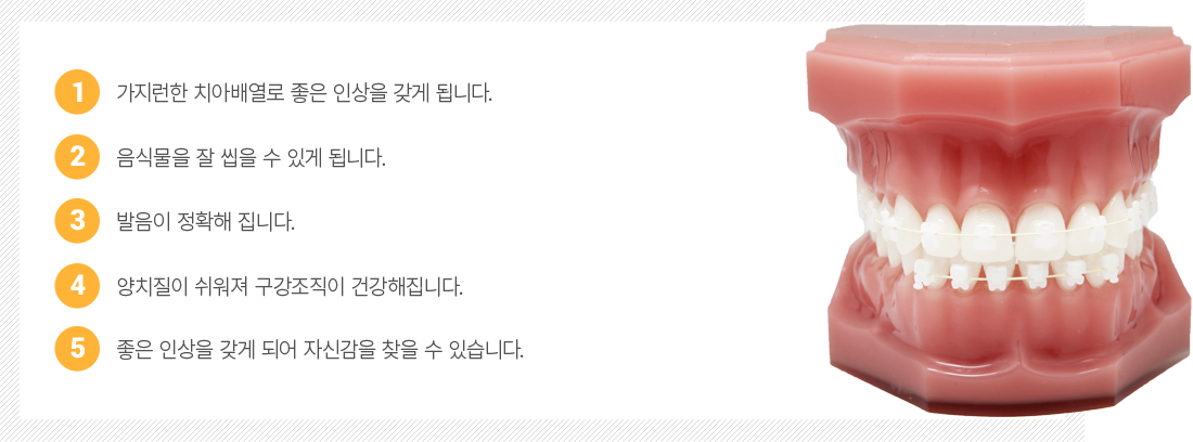 S-line���� ����