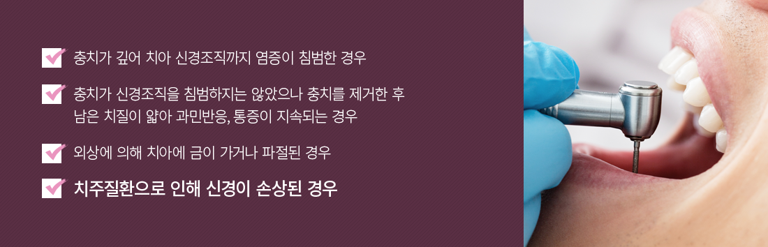 �Ű�ġ�ᰡ �ʿ��� ���