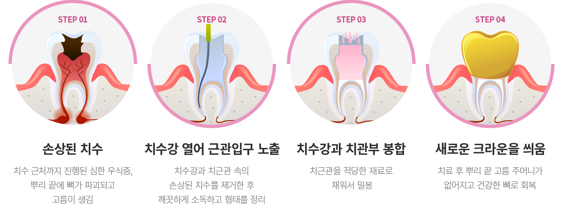 �Ű�ġ�� ����